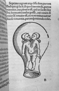 Enfants siamois, illustration du soi-disant manuscrit Rhodion