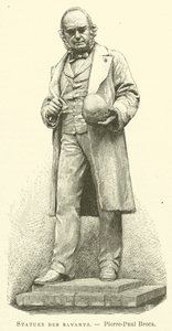 Statues des savants, Pierre-Paul Broca