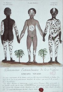 Le Phénomène de la Leucodermie - French School