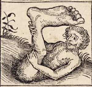 Un sciopode, Homme avec un pied enflé, de 