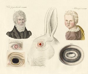 Albinos