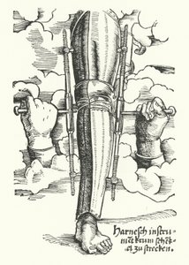 Dispositif pour redresser une jambe blessée - German School