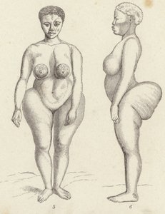 Vénus hottentote