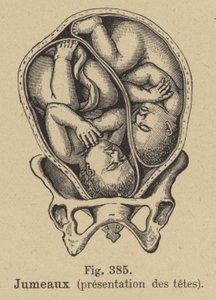 Jumeaux dans le ventre de leur mère