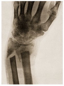Radiographie d