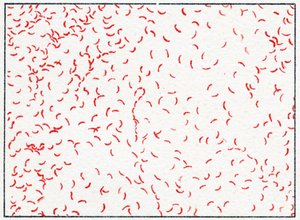 Bactérie Vibrio cholerae