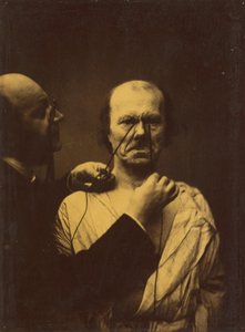 Agression, méchanceté - Guillaume Benjamin Amant Duchenne