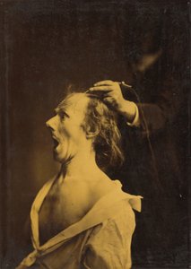Étonnement, stupéfaction, émerveillement - Guillaume Benjamin Amant Duchenne