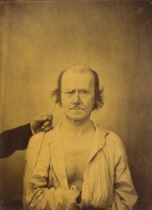 Attention (gauche); Réflexion (droite) - Guillaume Benjamin Amant Duchenne