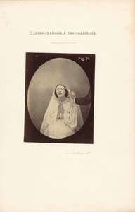 Électro-Physiologie Photographique, Figure 76 - Guillaume Benjamin Duchenne