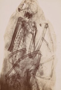 [Radiographie de la momie d