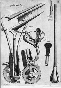Gynécologie : Planche représentant un spéculum. Gravure de Girolamo Fabricii dans « Opera Surgica », Padoue - Hieronymus Fabricius ab Aquapendente