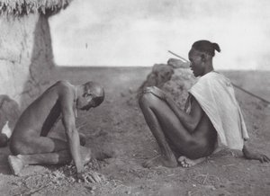 Afrique : Guérisseur saignant un patient - Hugo Adolf Bernatzik