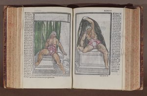 Anatomie féminine, de Commentaria cum amplissimis additionibus super anatomiam mundini, par Jacopo Berengario da Carpi, publié à Bologne, 1521 (gravure sur bois en couleur) - Italian School