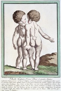 Enfants siamois - dans "Les déviations de la nature" par Régnault - Jean Baptiste Regnault