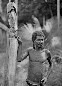 Malformation des oreilles, Îles Salomon, 1920 - John Watt Beattie