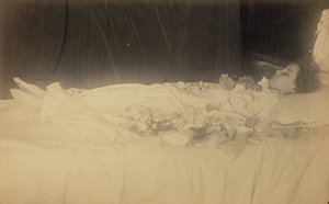 [Étude d