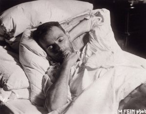 Egon Schiele sur son lit de mort, 1918