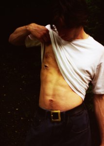 Plaie - Mat Collishaw