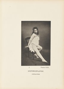 Hystéro-Épilepsie Contracture