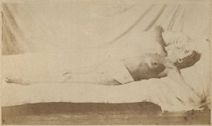 Épilepsie hystérique, attaque, crucifixion, planche VI de 