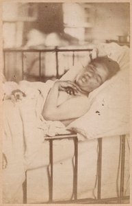 Épilepsie hystérique, contraction permanente, planche XXVIII de 