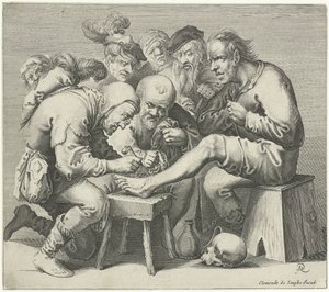 Opération du pied