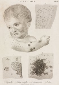 Dermatologie Types de maladies de la peau