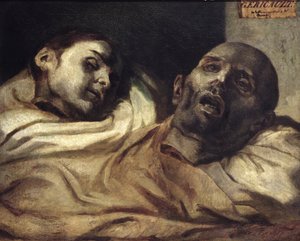 Têtes de Victimes de Torture