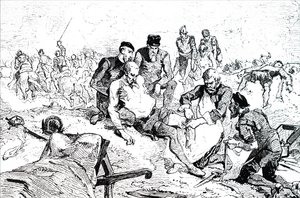 Ambroise Paré ligaturant des artères après amputation - Unbekannt