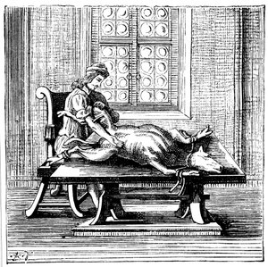 Transfusion de sang animal à humain, 1679 - Unbekannt