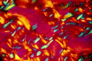 Biomatériaux, os