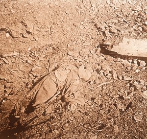 Corps de soldat mort, Verdun, nord de la France
