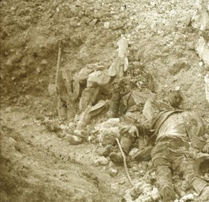 Corps de soldat mort, vers 1914-1918
