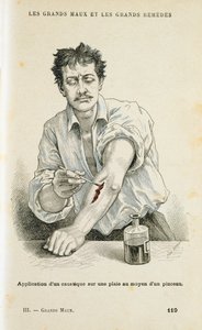 Peindre une plaie avec une solution antiseptique, vers 1890 - Unbekannt