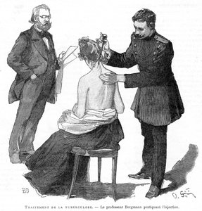 Le professeur Bergmann injectant un patient tuberculeux, 1891