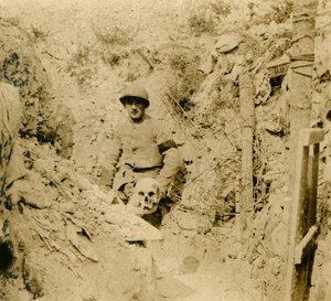Crâne trouvé enterré dans les tranchées, vers 1914-1918 - Unbekannt