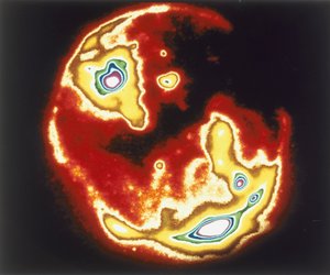 Image radiographique du soleil, Skylab, années 1970