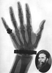 Radiographie d