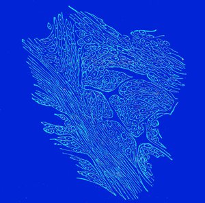 Section transversale de tumeurs fibro-nucléées - Unbekannter Künstler