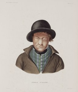 Maladies, Lèpre Lépreux mâle, Islande, début 19e siècle - Unbekannt