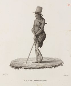 Maladies, maladies tropicales Homme avec éléphantiasis, Guam - Unbekannt