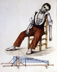 Patient atteint de choléra - Unbekannter Künstler