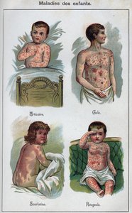 Maladies des enfants : Urticaire, Rougeole, gale, scarlatine. Dans "La nouvelle médication naturelle" de F.E. Bilz