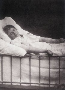 Hystéro-épilepsie - Attaque de tétanisme dans « Iconographie photographique de la Salpêtrière : service de M. Charcot » par Paul Regnard et Bourneville - Unknown artist