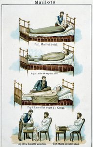Jerseys : 1) Jersey total, 2) Bain de vapeur au lit, 3) Jersey court Kneipp, 4-5) Jersey pour mollets - dans « Bilz, Médication naturelle », fin du XIXe siècle