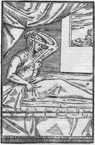 Chirurgie du nez : Chirurgie reconstructive du nez dans « De curtorum chirurgia per insitionem ». Venise - Unknown artist