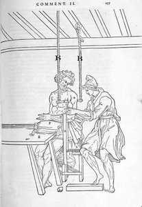 Réduction des fractures. Planche illustrée de « De dissectione partium corporis humani libri tres... » par Carlo Stefano Riverio, Paris 1545. - Unknown artist