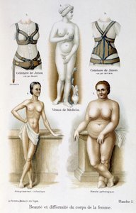 Beauté et difformité du corps de la femme (maigreur et obésité) ; Ceintures de Junon - dans « La femme, médecin du foyer »