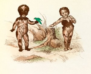 Petite fille couverte de taches de poils (gravure)